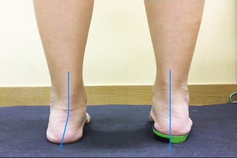 Insole Duck 足弓承托調較鞋墊